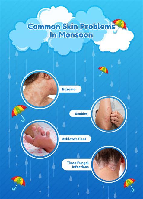 Common Skin Problems In Monsoon Skin And Hair Academy