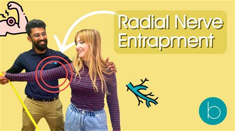 The Ultimate Guide To Radial Nerve Entrapment Youtube