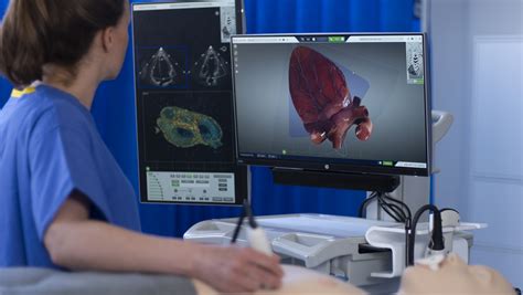 Heartworks Intelligent Ultrasound