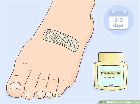 3 Ways To Heal Blisters Fast Wikihow