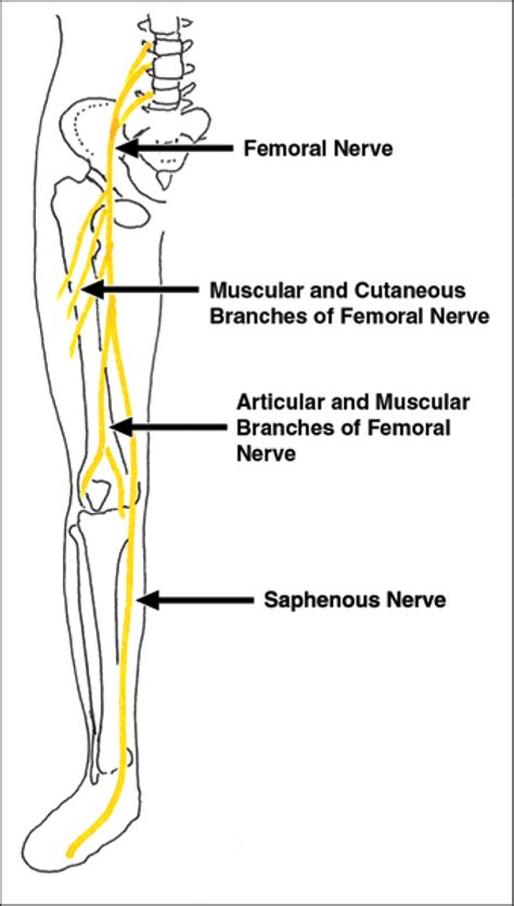 Femoral Neuropathy Common Causes Pressure From Inguinal Ligament My