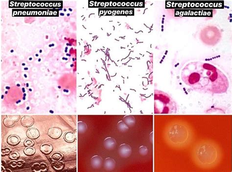 1 Streptococcus Pneumoniae 2 Streptococcus Pyogenes 3 Streptococcus