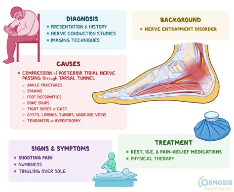 Tarsal Tunnel Syndrome What Is It Causes Treatment And More Osmosis
