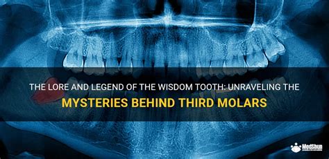 the lore and legend of the wisdom tooth unraveling the mysteries behind third molars medshun