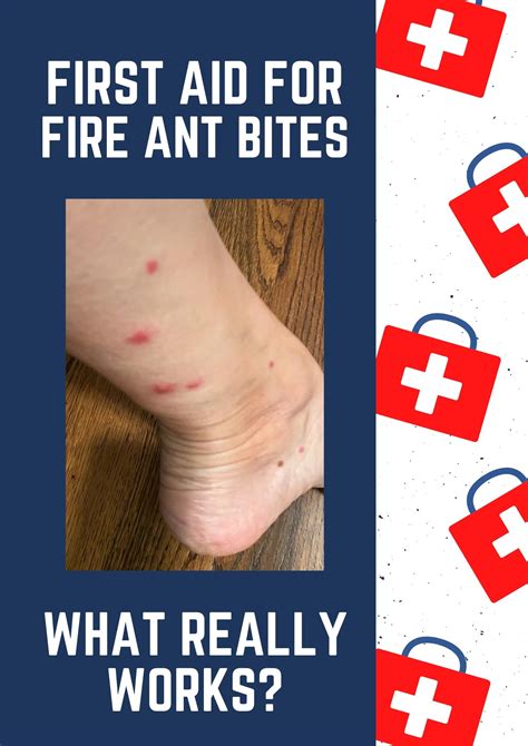 Fire Ant Bites Pictures Austra Health