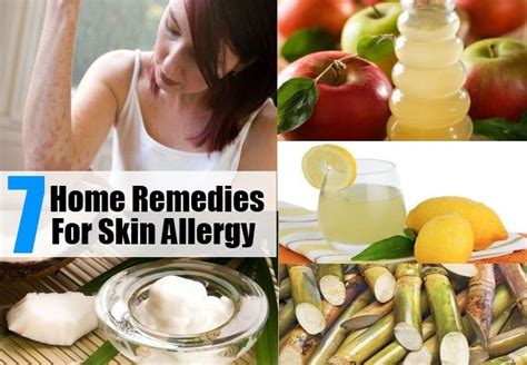 7 Home Remedies For Skin Allergy Home Remedies For Allergies Natural