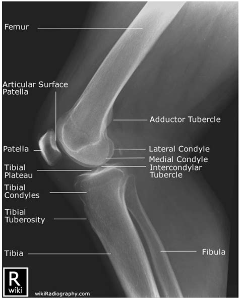 Knee Anatomy Anterior View