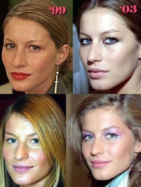 Gisele Bundchen Plastic Surgery Before And After Celebrity Noses