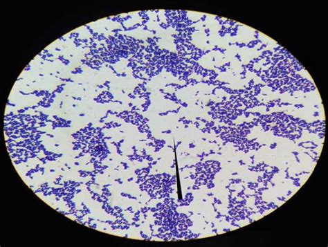 Grams Staining Under ×100 Oil Immersion Colony Morphology And Gram