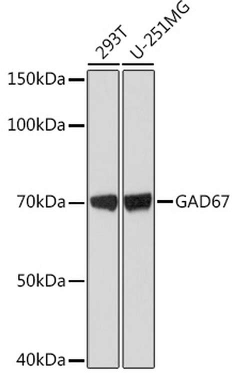 Gad67 Recombinant Monoclonal Antibody Arc1879 Ma5 37849