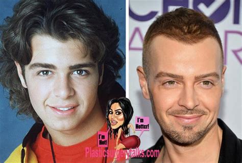 Joey Lawrence Plastic Surgery Hair Transplant Before And After