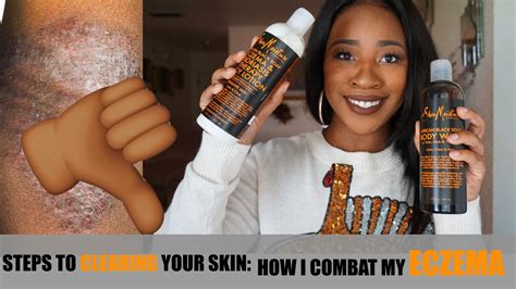 Tips To Combat Eczema On Dark Skin My Current Body Products Youtube