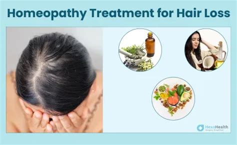Top Homeopathy Medicines For Hair Loss Treatment
