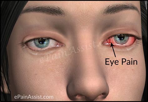 Eye Pain Types Causes Signs Eye Examination Treatment