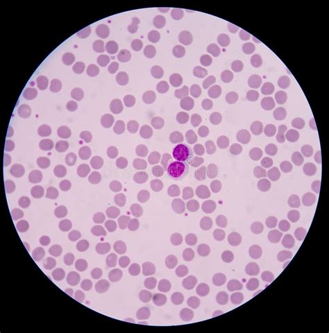 Lymphocyte Cells In Blood Smear Stock Image Image Of Care