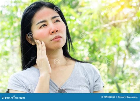 Asian Woman Having Face Skin Problem With Sunburn Redness From Ultraviolet Of Sunlight Standing