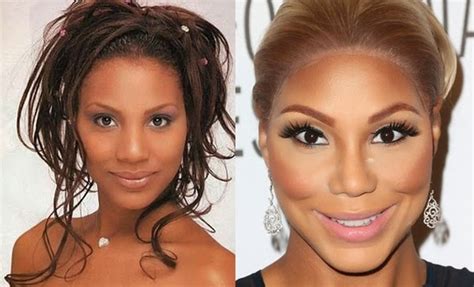 Tamar Braxton Before And After Plastic Surgery