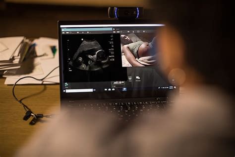 Philips Debuts First Of Its Kind Tele Ultrasound Solution News Philips