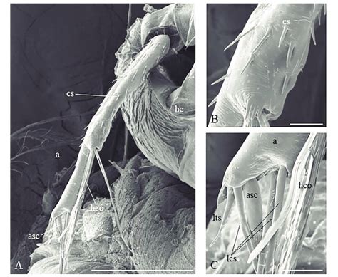 Scanning Electron Micrograph Of The Antenna Of Cx Pipiens Fourth Download Scientific Diagram