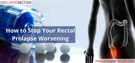 How To Stop Your Rectal Prolapse Worsening