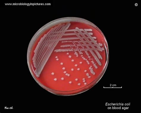 E Coli Escherichia Coli An Overview Microbe Notes
