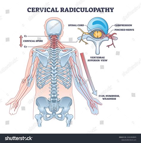 2017 Anatomy Cervical Nerves Images Stock Photos And Vectors Shutterstock