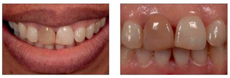 Exploring The Journey Of Dan Hughes At QVC