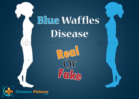 What Is A Blue Waffle Disease Real Or Fake Is Blue Waffles Disease A Std Healthmd