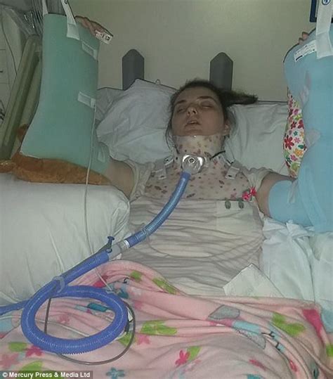 Teenage Girl Had To Be Wired Together Before She Fell Apart Daily