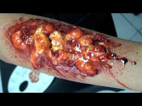 Acids have free h+ ions that have a tenancy to attack and burn and sometimes dehydrate organic materials, such as your skin. Gooey Acid Burn SFX Makeup - YouTube