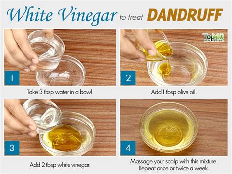 Natural Remedies For Dandruff How To Get Rid Of Dandruff 12 Natural