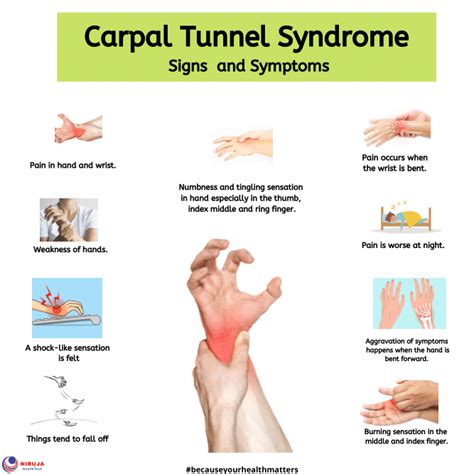 Carpal Tunnel Syndrome Carpal Tunnel Syndrome