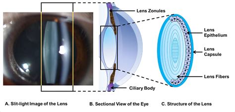 Write The Structure Of The Eye Lens And State The Role Of Ciliary