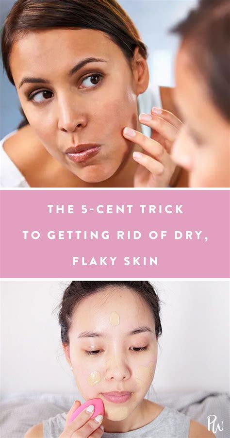 The 5 Cent Trick To Getting Rid Of Dry Flaky Skin Flaky Skin Skin