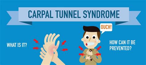 Carpal Tunnel Syndrome Treatment Active Clinics
