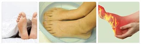 Burning Feet Syndrome Basics The Internet Faqs