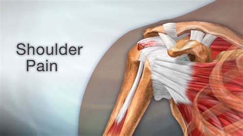 Rotator Cuff Muscles Pain Discount Sale Save 60 Jlcatjgobmx