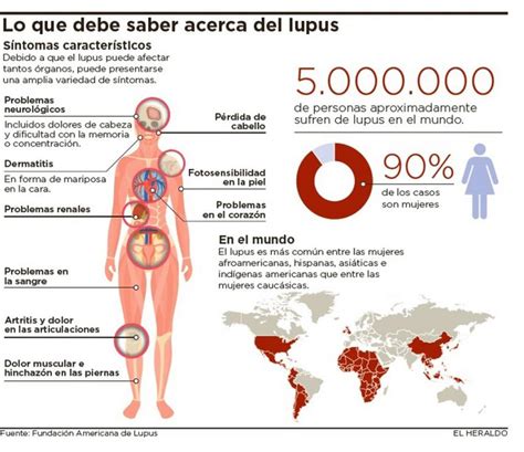 Infografía Lo Que Debe Saber Acerca Del Lupus El Heraldo