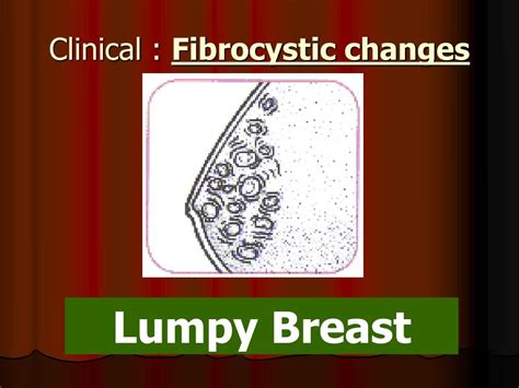 Ppt Breast Disease Powerpoint Presentation Free Download Id1368363