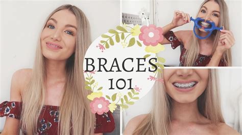 How To Know If We Need Braces 12 Things You Should Know Before Getting Braces Biermann
