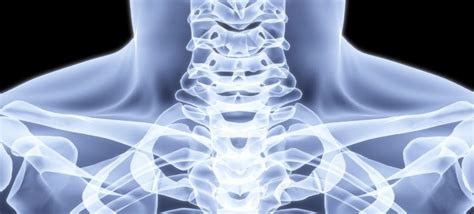 What Is A Facet Rhizotomy Minneapolis Spine Doctor Stefano Sinicropi
