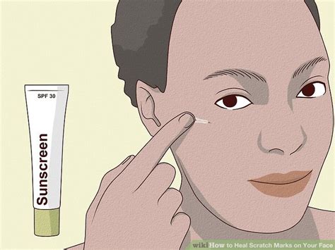 Learn How To Do Anything How To Heal Scratch Marks On Your Face