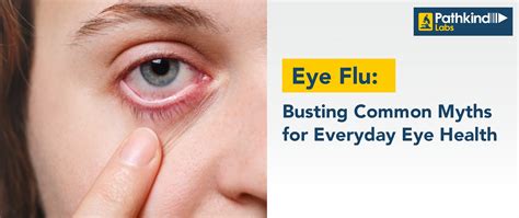 Eye Flu Busting Myths For Eye Health Pathkind Labs