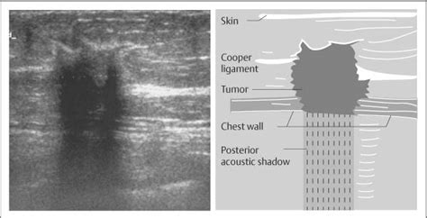 Basic Principles Radiology Key