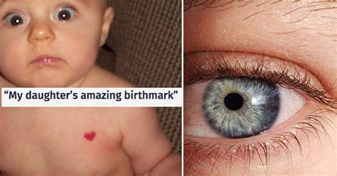 Cool Shaped Birthmarks