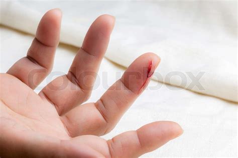 Injured Finger With Bleeding Open Cut Stock Image Colourbox