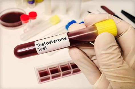 Testosterone Test Kit Home Your T Under Your Control