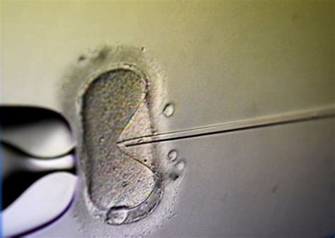 Ny Tells Health Insurers To Speed Up Fertility Coverage For Same Sex Couples