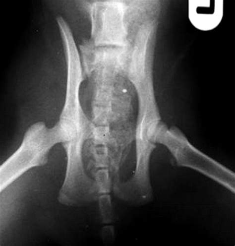 Find out the number one partially dislocated hip symptoms may be more subtle than those of a complete dislocation. Open reduction and placement of an iliofemoral anchor ...