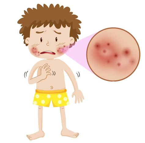 It's an autoimmune disease, which means that your immune system — the body system that usually fights infections — attacks healthy tissue instead. Tratamiento con Células Madre para Lupus , Terapia ...